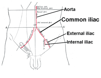 Arterie iliache